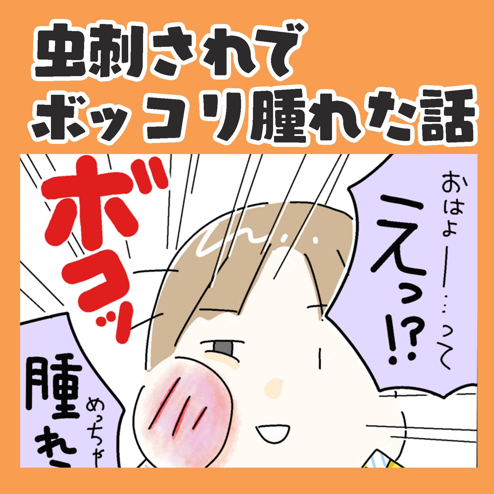 たかが虫刺されという勿れ。２歳息子の頬がめっちゃ腫れて勉強になりました！｜ホッターの子育て絵日記